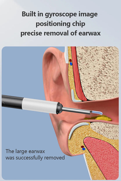 HD Visible Earwax Removal Tool